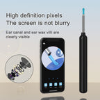 6-in-1 Smart Ear Wax Removal Kit with 1080P HD Camera – Safe, Rechargeable Ear Cleaner for iPhone, iPad & Android